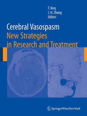 cover image of Cerebral Vasospasm